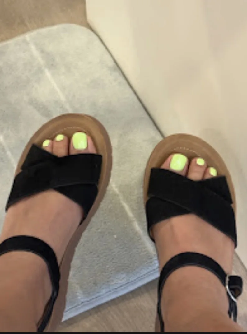 Neon Yellow Pedicure